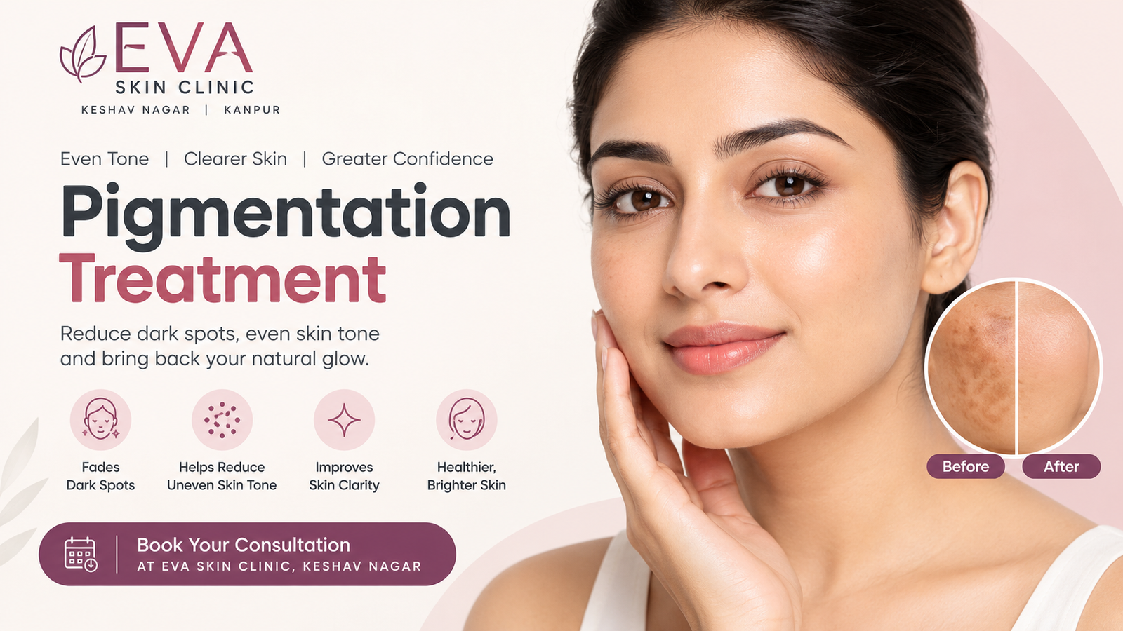 Best Pigmentation Treatment in Kanpur | EVA Skin Clinic