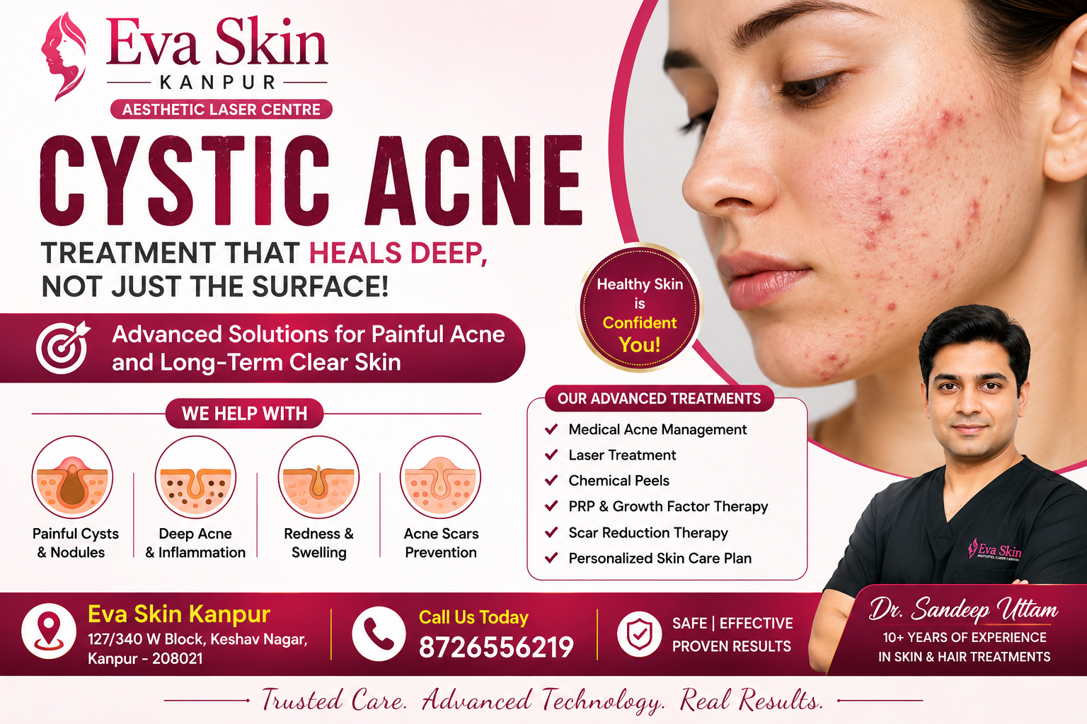 Acne Treatment: Causes, Effective Options & When to See a Skin Doctor