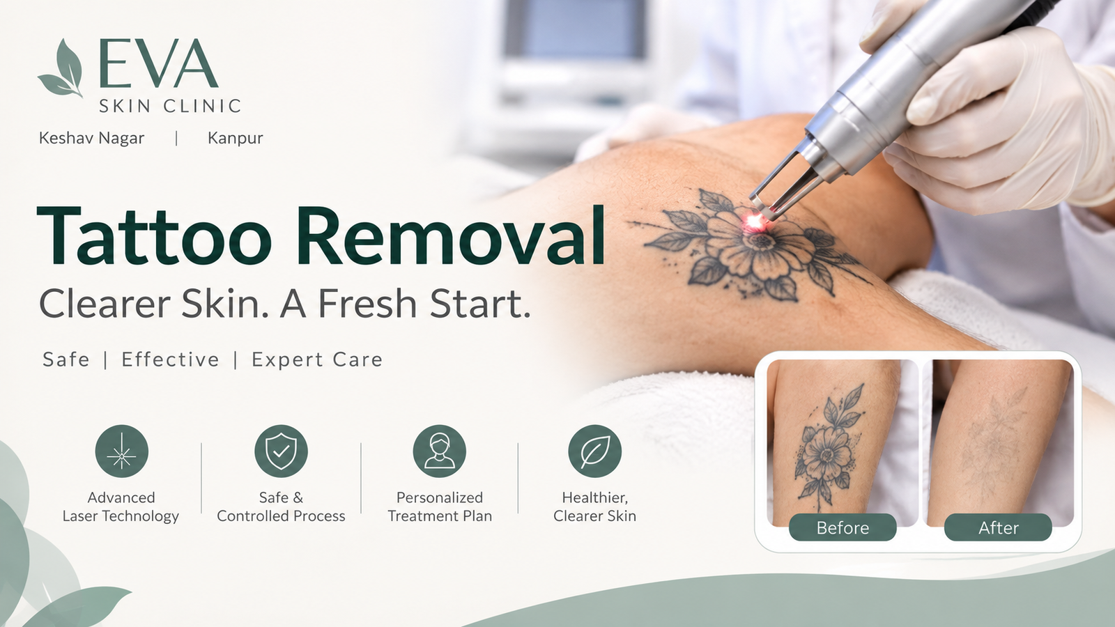 Tattoo Removal Treatment: Options, Process, Safety & What to Expect
