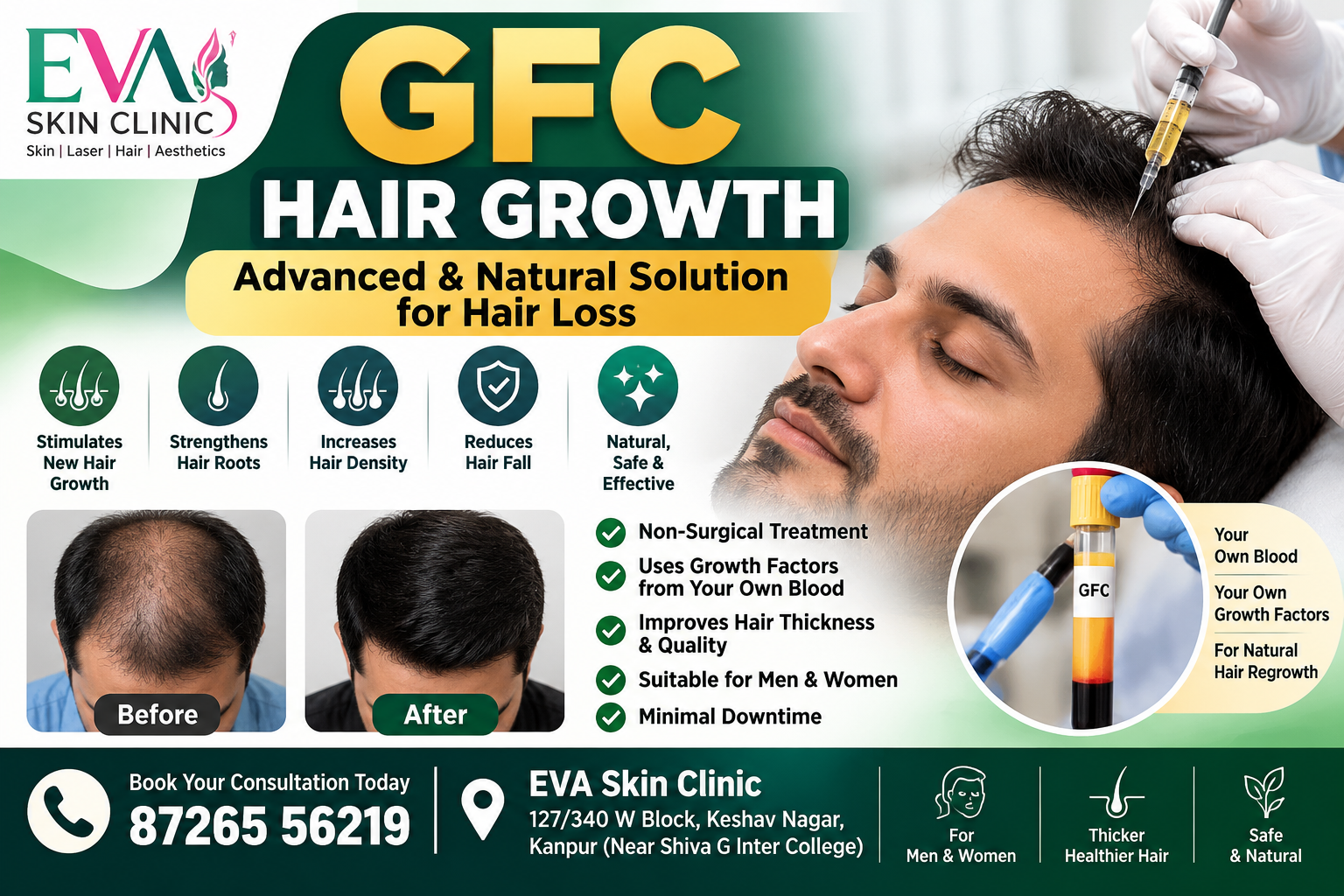 Best Treatment for Hair Fall and Baldness in Kanpur